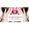 secretveneers.online Logotype